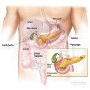 대장암 췌장암 이미지