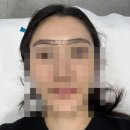 강동-천호-2438 | 강동 눈썹 문신 잘하는 미작뷰티. 짱구눈썹 걱정 🙅‍♀️NO
