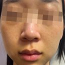 돋보기피부과의원 | 삼각지역피부과 후기｜기미잡티 색소치료 전문의가 답하는 Q&A