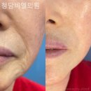 비엘의원 이미지