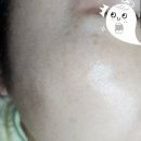 리지엔피부과의원 | [경기/망포역] 오체안피부과 2차 치료 후기/ 내돈내산