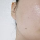 용산-167 | [용산역피부관리] 용산웨딩관리 온플릭 에스테틱 리베룩 관리