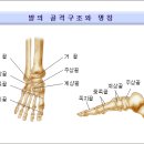 발의 골절이란 이미지