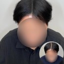 레이븐스칼프