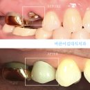 바른이치과기공소 이미지