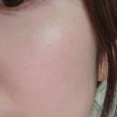 안티솔라 이미지