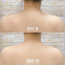 휠로스인약손