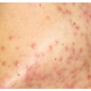 원큐메디 | 아그네스 구매 및 중고, 데모까지 메디원큐에서 진행!