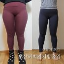 부산지방흡입 허벅지 전체 한달차 육아맘 솔직후기