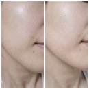 (주)워터케어 | 엑소프록실 시카 엑소좀 미네랄 워터 토너패드 건성피부 기미잡티 케어
