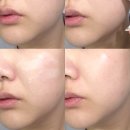 그린온누리약국 | 약국크림 찾는다면? 지피덤 EGF크림 맥스 베리어 크림 사용 후기