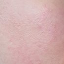 UV메디칼 이미지