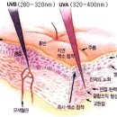 장마철 특히 주의해야할 피부질환 5가지 이미지