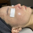 무리바 케어 이미지