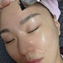 인디자인 | 포항 이동 피부관리 인디자인페이스 피부관리 후기