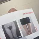 허벅지 팔뚝 지흡 발품 후기 : 강남역 ㅁㄷㄹㅇ