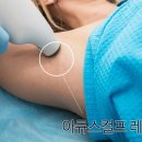 스마트테크닉