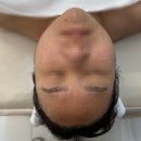 온뷰티샵 | 홍대입구역 피부관리 추천✨ 리프팅 케어 받고 온 토탈뷰티샵 뷰아즈 후기