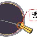청주밝은안과의원