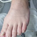 연향번영길 | 광양내성발톱 고민 해결 레푸스 순천연향점