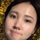 D-12 | 3ㅣ눈썹문신제거레이저 1회차 내돈내산 후기 (D+12~D+25)