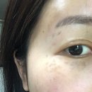 서울제일성형외과의원 이미지