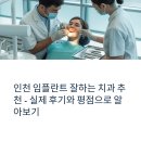 인천 임플란트 잘하는 치과 추천: 거짓 없는 후기와 평점으로 정리