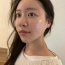 호텔오비탈 | 압구정로데오피부과 튠페이스 당일부터 10일차 변화 내돈내산 후기