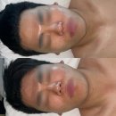 만덕1동-1 | 브이오미에스테틱 부산 피부관리 남자 추천