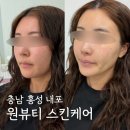 원뷰티스킨케어홍성 | 충남 원뷰티 스킨케어 홍성내포점 피부관리 숨결클렌징 추천