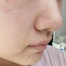 메디율 | 데일리 모공팩으로 사용하는 메디율 율무팩 사용 후기