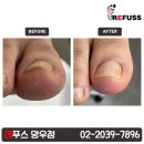 레푸스 망우점 이미지