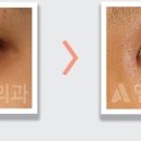 앤써성형외과의원 이미지