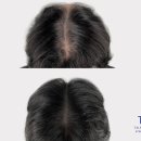 탈모왕 광주점 이미지