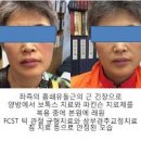 근긴장이상증 사경증, 근육 눈꺼풀 떨림, 목이 조이는 느낌 이미지