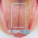 민강한의원 네이버블로그