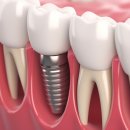 울산스마트치과의원 이미지
