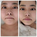 서면피부관리, 서면윤곽관리 콤마에스테틱 전포점에서 신부관리로 윤곽관리 받았어요