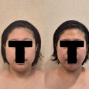 잠실새내피부관리 유명한 위뷰티잠실점 턱쉐딩피부관리 자기개발 후기