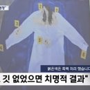 mbc가 이재명 대표 혈흔 셔츠 공개했어요 이미지