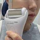 노원역 5번출구 | 노원역 쥬베룩볼륨 앞광대 팔자주름 내돈내산 후기