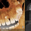 노형큐치과의원 이미지