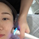 산호초등학교 | 마산 여드름관리 잘하는 곳, 스며들하루 여드름케어 후기