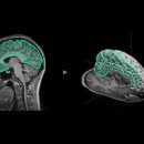 인-메디 이미지