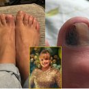 멍is뭔들 이미지