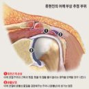 류현진(야구선수) 어깨고장과 피부관리사의 어깨 고장 이미지