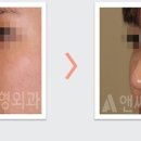 앤써성형외과의원 이미지