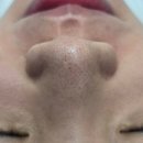 양산동 피부관리 제이샵뷰티 모공관리 후기