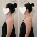 빽다방천안신부동아점 | 청주 림프순환 관리 온바디｜율량동 상체관리로 상체 라인 달라진 후기