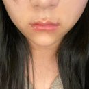 아영이네에서 요양/대구 [일상 8주]